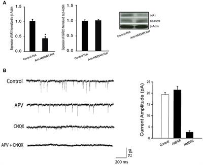 Neuronal NMDAR Currents of the Hippocampus and Learning Performance in Autoimmune Anti-NMDAR Encephalitis and Involvement of TNF-α and IL-6